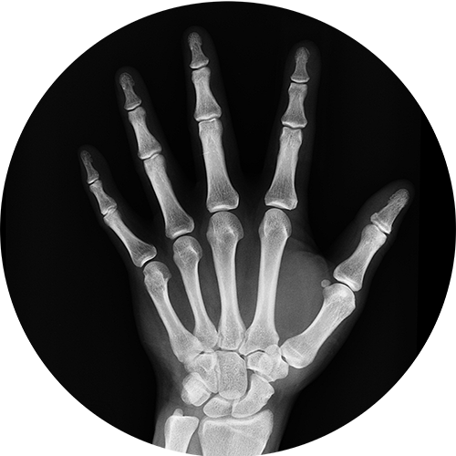 XRAY SERVICES